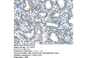 Human Lung (HOXC9 antibody  (Middle Region))