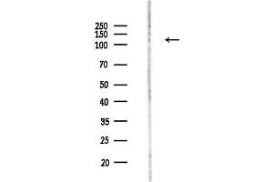 anti-PHD Finger Protein 8 (PHF8) (C-Term) antibody