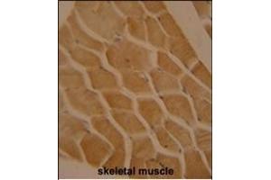 LMOD2 antibody (N-term) (ABIN654322 and ABIN2844103) immunohistochemistry analysis in formalin fixed and paraffin embedded human skeletal muscle followed by peroxidase conjugation of the secondary antibody and DAB staining.