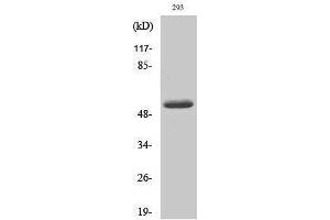 Western Blotting (WB) image for anti-Matrix Metallopeptidase 14 (Membrane-inserted) (MMP14) (cleaved), (Tyr112) antibody (ABIN3179351) (MMP14 antibody  (cleaved, Tyr112))