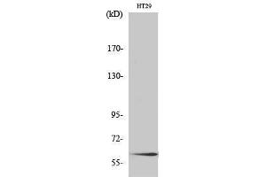 Western Blotting (WB) image for anti-SMAD, Mothers Against DPP Homolog 2 (SMAD2) (Ser795) antibody (ABIN3186984) (SMAD2 antibody  (Ser795))