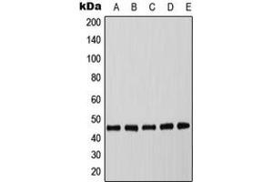 Western blot analysis of C/EBP alpha (pT226) expression in MCF7 EGF-treated (A), mouse spleen (B), mouse liver (C), rat spleen (D), rat liver (E) whole cell lysates. (CEBPA antibody  (pSer226))