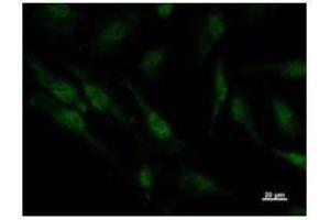 Immunostaining analysis in HeLa cells. (PSMC5 antibody)