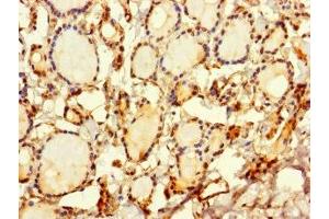 Immunohistochemistry of paraffin-embedded human thyroid tissue using ABIN7169648 at dilution of 1:100 (SRP19 antibody  (AA 2-144))