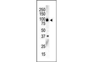Western blot analysis of anti-PKCnu C-term Pab in NCI-H460 cell lysate.