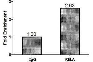 Immunohistochemistry (IHC) image for anti-Nuclear Factor-kB p65 (NFkBP65) (AA 1-210) antibody (ABIN7172586)