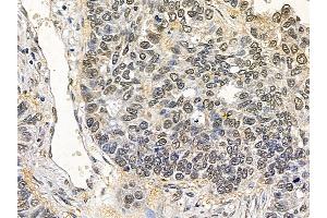 anti-Homeobox Containing 1 (HMBOX1) (N-Term) antibody