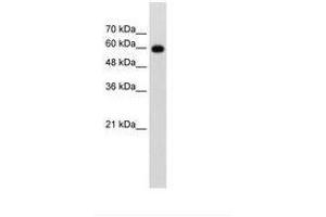 Image no. 1 for anti-Cell Division Cycle 23 (CDC23) (AA 101-150) antibody (ABIN203478)