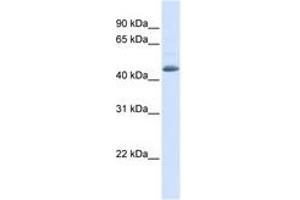 Image no. 1 for anti-Sorting Nexin 5 (SNX5) (AA 72-121) antibody (ABIN6741276) (SNX5 antibody  (AA 72-121))