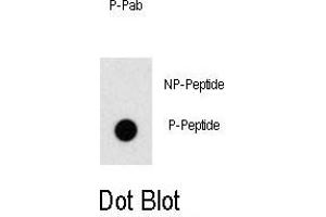 Dot blot analysis of anti-Phospho-ZBTB16-p Antibody (ABIN389958 and ABIN2839759) on nitrocellulose membrane.