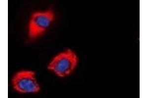 Immunofluorescent analysis of GAP43 (pS41) staining in SHSY5Y cells. (GAP43 antibody  (N-Term, pSer41))