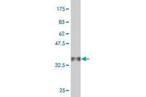 Western Blot detection against Immunogen (36. (PET112L antibody  (AA 466-556))