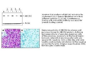 Immunohistochemistry (IHC) image for anti-ATP-Binding Cassette, Sub-Family A (ABC1), Member 1 (ABCA1) antibody (ABIN187475) (ABCA1 antibody)