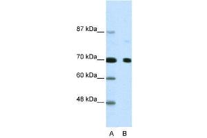 WB Suggested Anti-NCOR2  Antibody Titration: 2. (NCOR2 antibody  (N-Term))