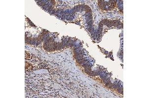 IHC analysis of SBP/SELENBP1 using anti-SBP/SELENBP1 antibody (ABIN7600755). (SELENBP1 antibody  (AA 23-462))