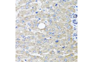 Immunohistochemistry of paraffin-embedded human liver injury using DFNA5 antibody (ABIN5975144) at dilution of 1/100 (40x lens). (DFNA5 antibody)