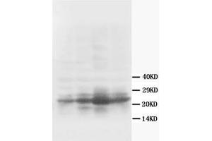 Western Blotting (WB) image for anti-Growth Associated Protein 43 (GAP43) antibody (ABIN1107311) (GAP43 antibody)
