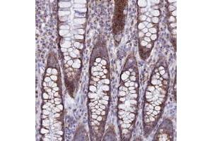 Immunohistochemical staining of human rectum with TMEM206 polyclonal antibody  shows strong cytoplasmic positivity in glandular cells at 1:20-1:50 dilution. (TMEM206 antibody)