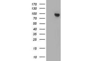 HEK293T cells were transfected with the pCMV6-ENTRY control (Left lane) or pCMV6-ENTRY CTNNB1 (Right lane) cDNA for 48 hrs and lysed. (CTNNB1 antibody)