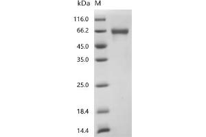 (Tris-Glycine gel) Discontinuous SDS-PAGE (reduced) with 5 % enrichment gel and 15 % separation gel.