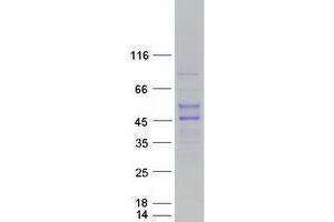 Validation with Western Blot