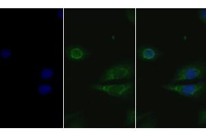 Detection of GSN in Human Hela cell using Polyclonal Antibody to Gelsolin (GSN) (Gelsolin antibody  (AA 674-782))