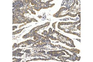 IHC analysis of TTK using anti-TTK antibody (ABIN7601844). (Mps1 antibody  (AA 487-821))