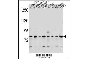 Western blot analysis in mouse NIH-3T3,Neuro-2a cell line and mouse stomach tissue and U251,A2058,A375,Sk-Br-3,T47D cell line lysates (35ug/lane). (DCBLD2 antibody  (C-Term))