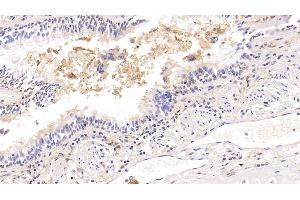 Immunohistochemistry (IHC) image for anti-Intercellular Adhesion Molecule 1 (ICAM1) (AA 41-464) antibody (ABIN7425926)