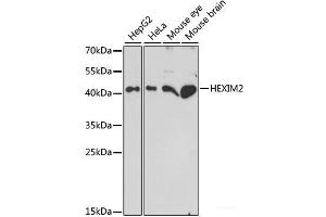 Western blot analysis of extracts of various cell lines using HEXIM2 Polyclonal Antibody at dilution of 1:1000. (HEXIM2 antibody)