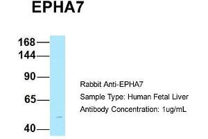 Host: Rabbit  Target Name: EPHA7  Sample Tissue: Human Fetal Liver  Antibody Dilution: 1. (EPH Receptor A7 antibody  (C-Term))