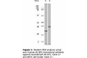 Image no. 2 for anti-Eukaryotic Translation Initiation Factor 4E Binding Protein 1 (EIF4EBP1) antibody (ABIN207631) (eIF4EBP1 antibody)