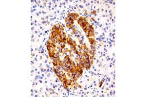 Immunohistochemical analysis of paraffin-embedded H. (MAPK10 antibody  (N-Term))