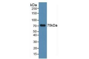 Detection of MAPT in Human Hela Cells using Polyclonal Antibody to Tau Protein (MAPT)