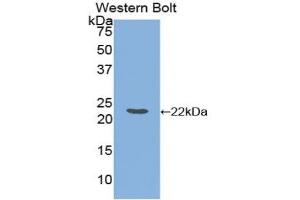 Detection of Recombinant FTL, Equine using Polyclonal Antibody to Ferritin, Light Polypeptide (FTL) (FTL antibody  (AA 1-175))
