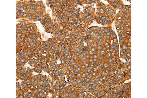 Immunohistochemistry (IHC) image for anti-Secreted Frizzled-Related Protein 1 (SFRP1) antibody (ABIN2432270)