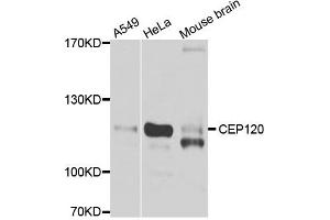 Western blot analysis of extracts of various cell lines, using CEP120 antibody. (CEP120 antibody)