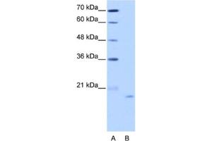 Western Blotting (WB) image for anti-Nucleolar Protein 6 (NOL6) antibody (ABIN2462296) (Nucleolar Protein 6 antibody)