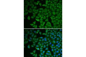 Immunofluorescence (IF) image for anti-Checkpoint Kinase 2 (CHEK2) (AA 1-220) antibody (ABIN6138520)