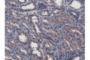 Detection of GAL2 in Porcine Kidney Tissue using Polyclonal Antibody to Galectin 2 (GAL2) (Gallinacin-2 (GAL2) (AA 1-123) antibody)