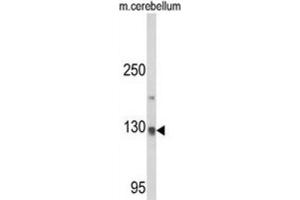 Western Blotting (WB) image for anti-CAP-GLY Domain Containing Linker Protein 1 (CLIP1) antibody (ABIN3003978) (CLIP1 antibody)