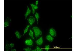 Immunofluorescence of monoclonal antibody to TIMP2 on HeLa cell. (TIMP2 antibody  (AA 27-220))