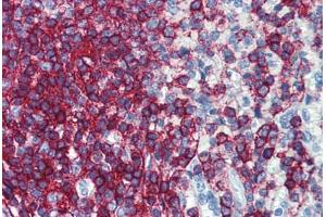 Human Spleen: Formalin-Fixed, Paraffin-Embedded (FFPE) (CD44 antibody  (FITC))