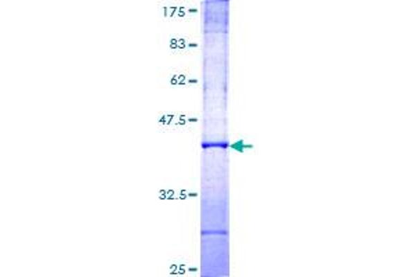 Fukutin Protein (FKTN) (AA 29-138) (GST tag)