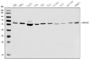 Western blot analysis of PFKFB2 using anti-PFKFB2 antibody (ABIN7601627).
