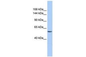 Image no. 1 for anti-Chromodomain Helicase DNA Binding Protein 2 (CHD2) (AA 36-85) antibody (ABIN6740379) (CHD2 antibody  (AA 36-85))