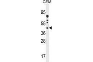Western blot analysis in CEM cell line lysates (35ug/lane) using DNAJC22 Antibody (C-term). (DNAJC22 antibody  (C-Term))
