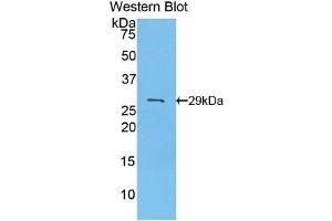 Detection of Recombinant PDK2, Mouse using Polyclonal Antibody to Pyruvate Dehydrogenase Kinase Isozyme 2 (PDK2) (PDK2 antibody  (AA 155-379))