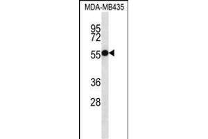 ASB4 antibody  (C-Term)