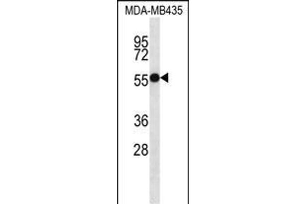ASB4 antibody  (C-Term)